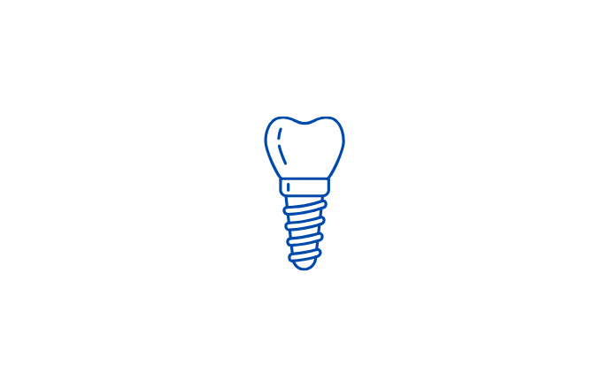 Dental implants